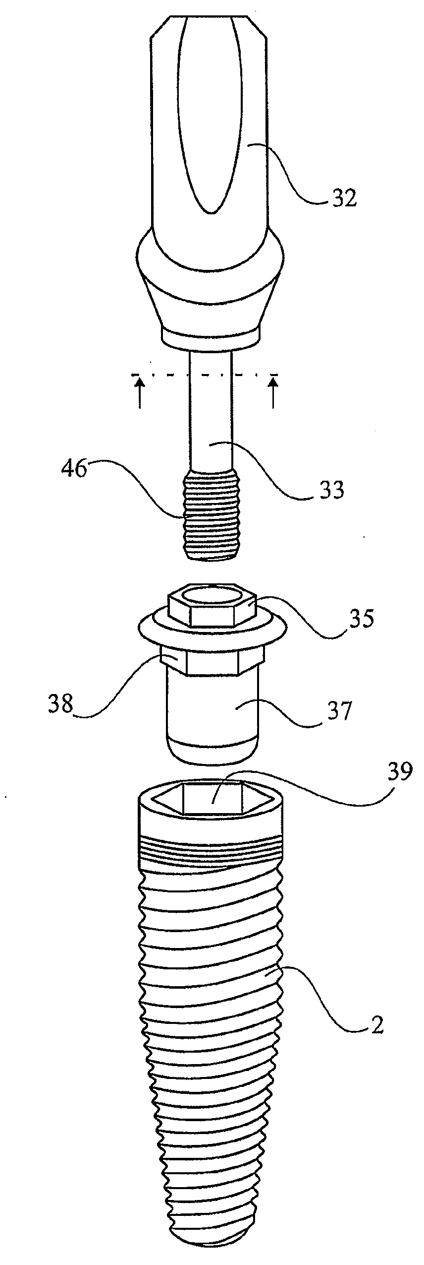 Device for securing a dental implant in bone tissue, a method for making a surgical template and a method of securing a dental implant in bone tissue