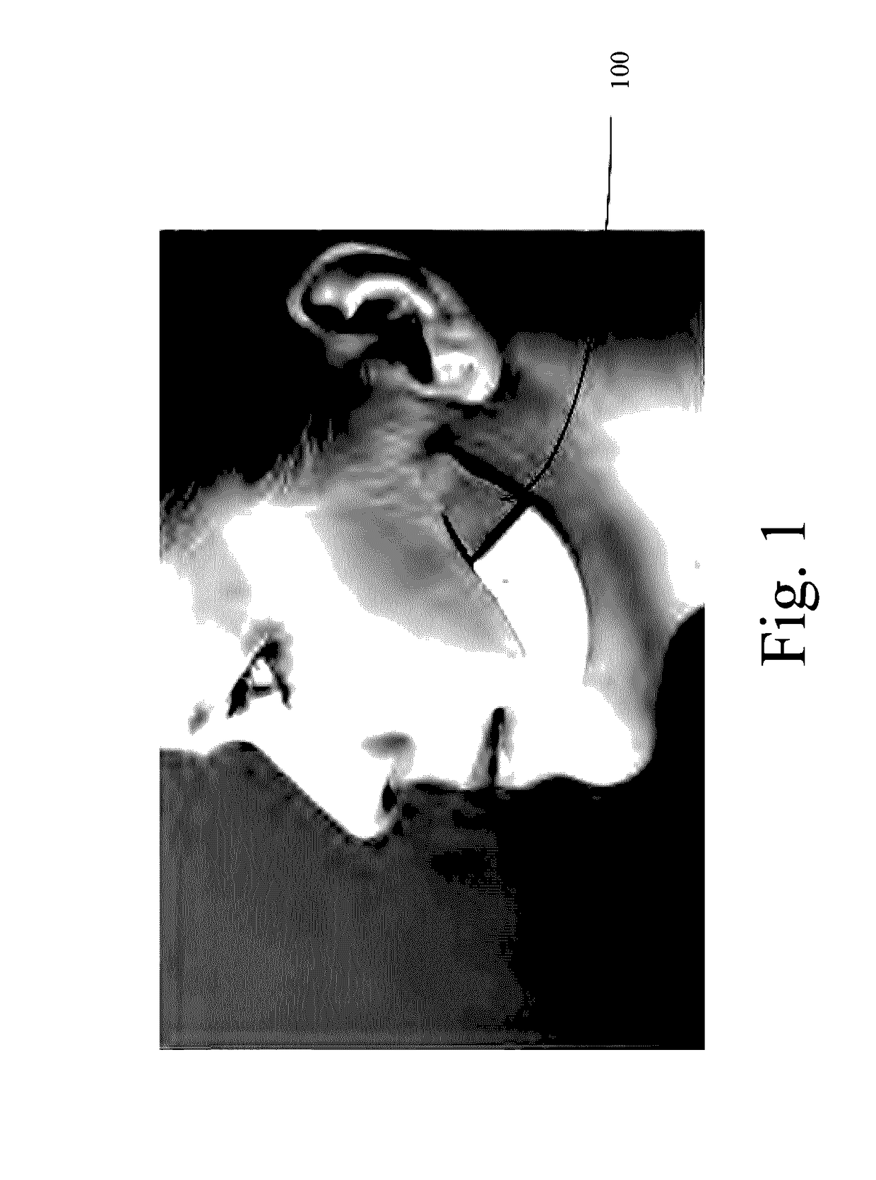 Apparatus and method for detecting bruxism