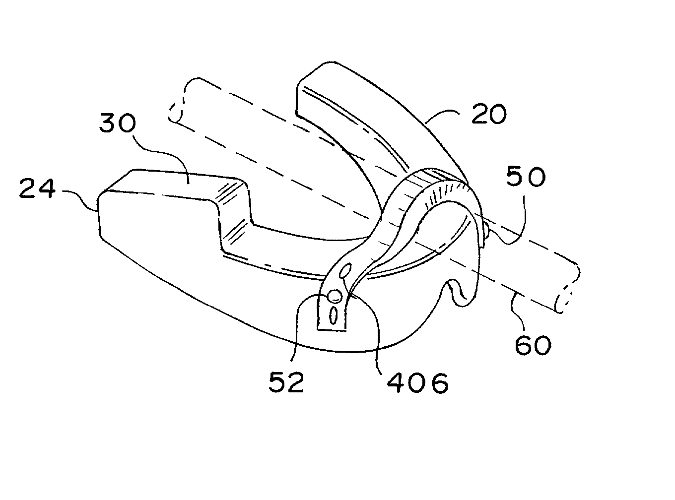 Catheter securing device