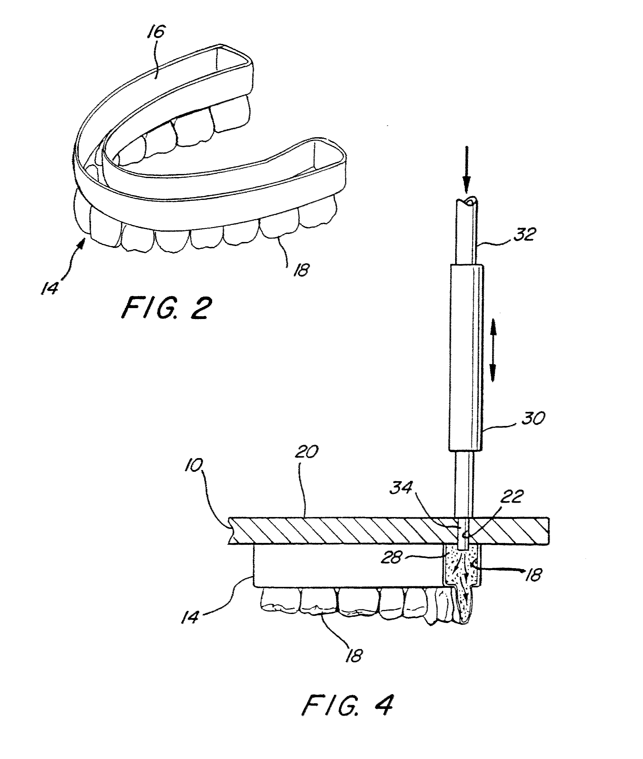 Reinforced thin-shell molds