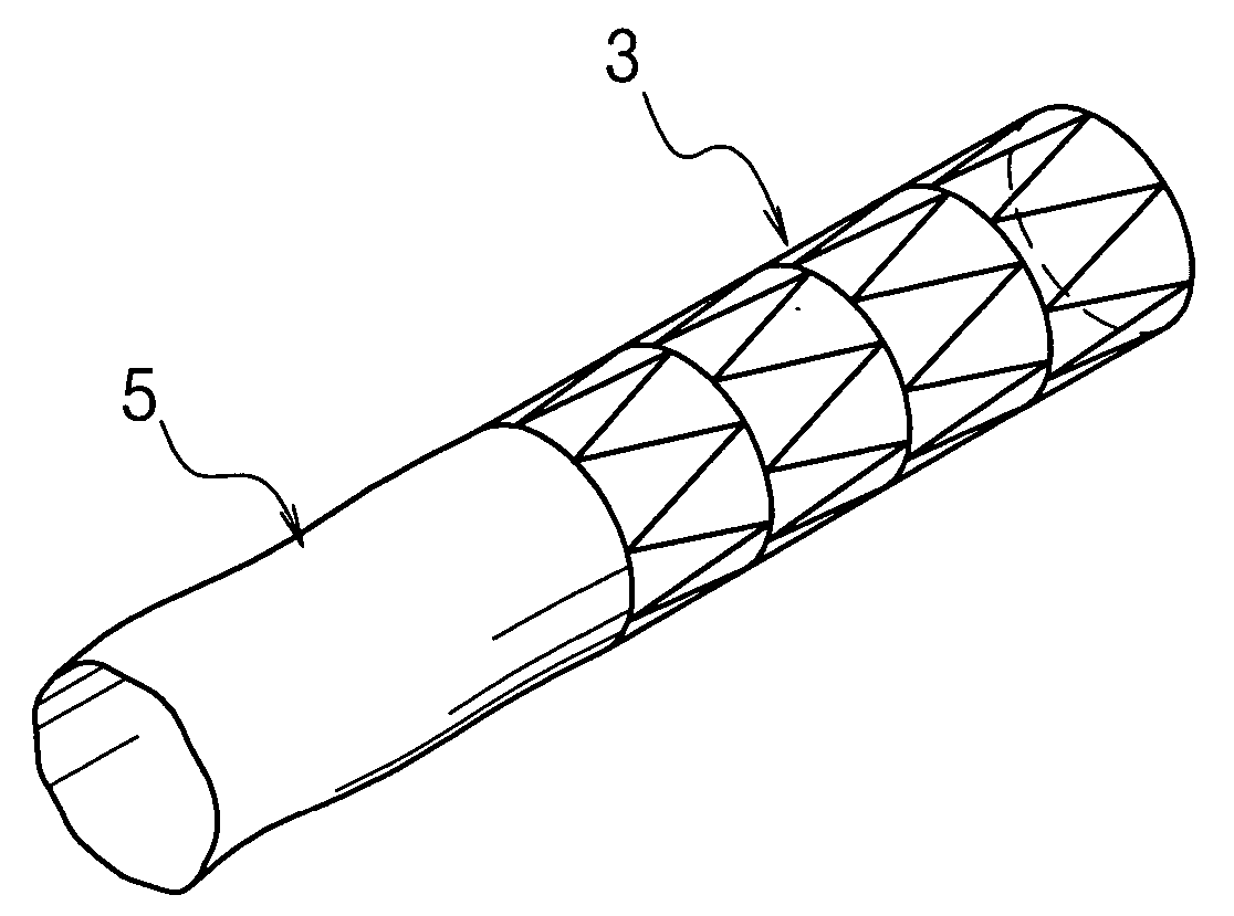 Esophageal stent