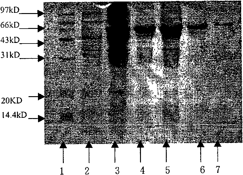 Anti-HER2 single-chain antibody-cefuroxime sodium enhanced fusion protein HER2(Fv-LDM)