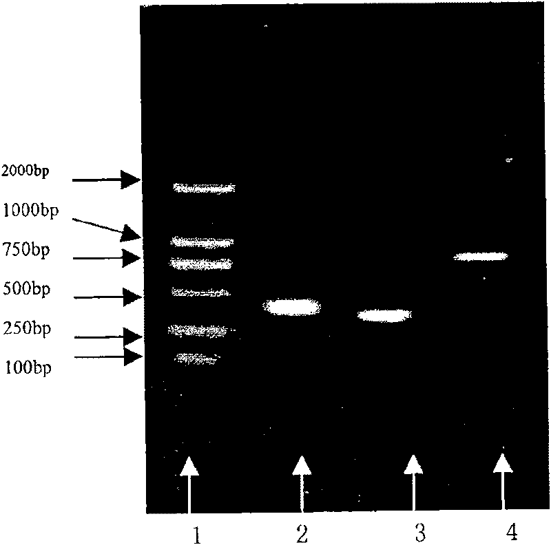 Anti-HER2 single-chain antibody-cefuroxime sodium enhanced fusion protein HER2(Fv-LDM)