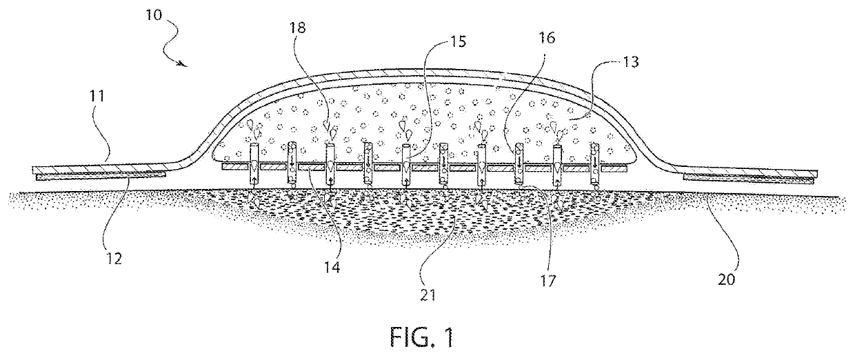 Bandage with microneedles for antimicrobial delivery and fluid absorption from a wound