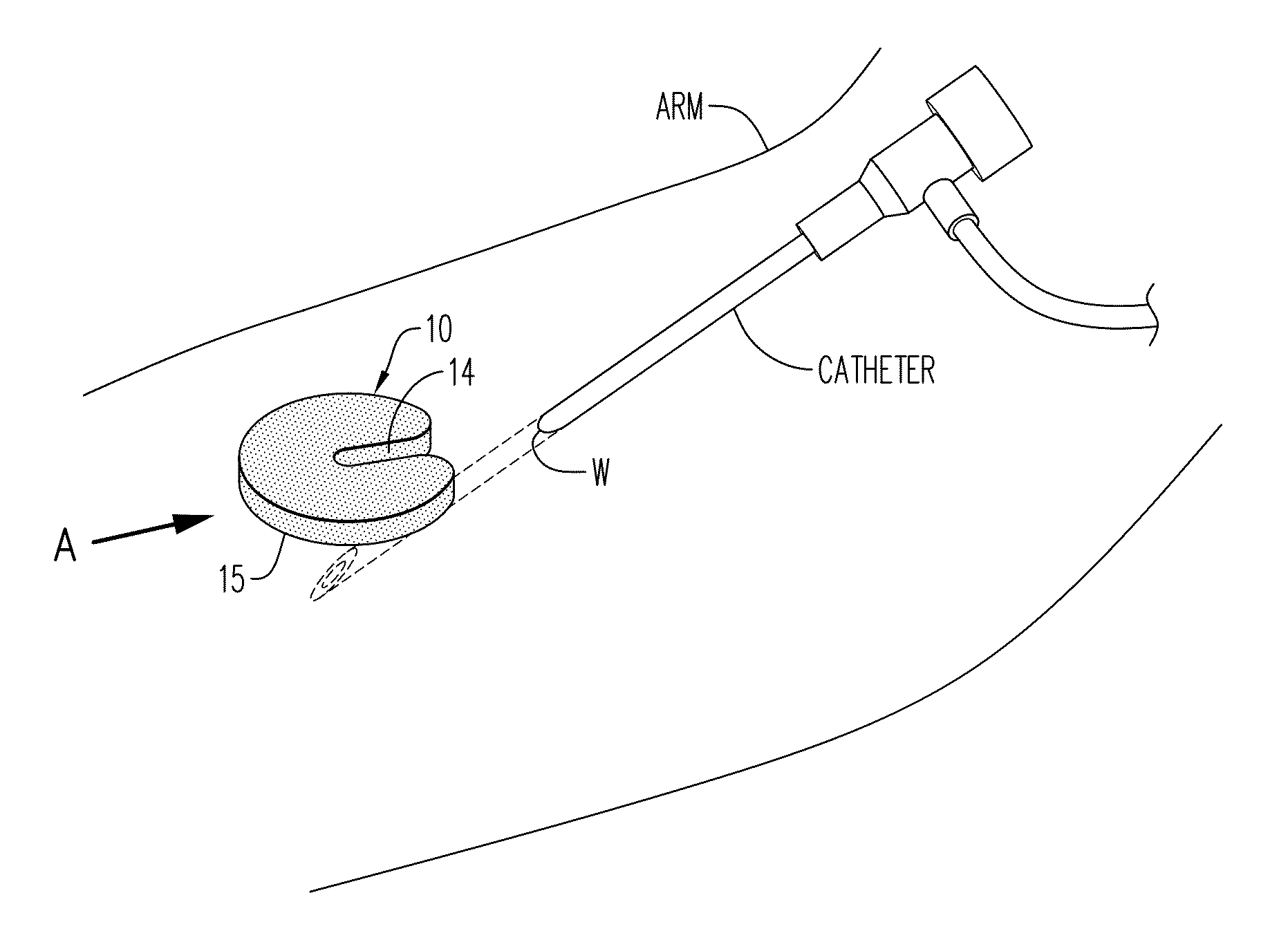 Hemostatic device and method