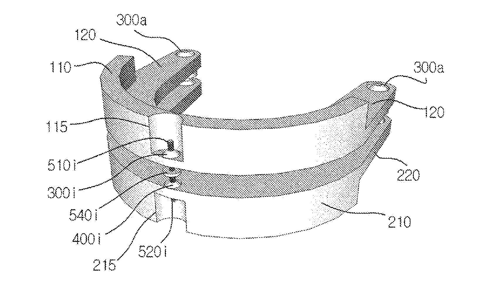 Orthopedic appliance for temporomandibular joint