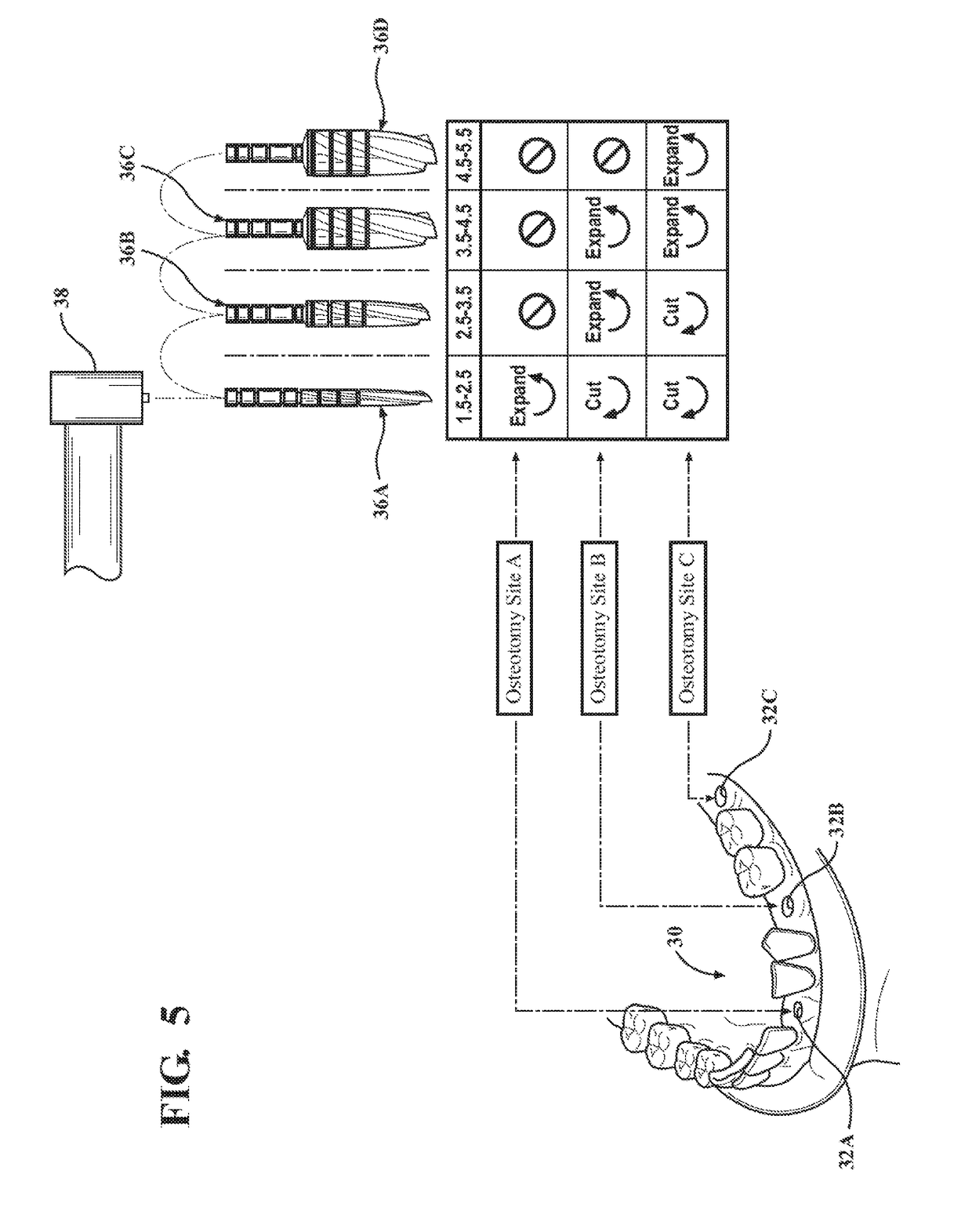 Autografting tool with enhanced flute profile and methods of use