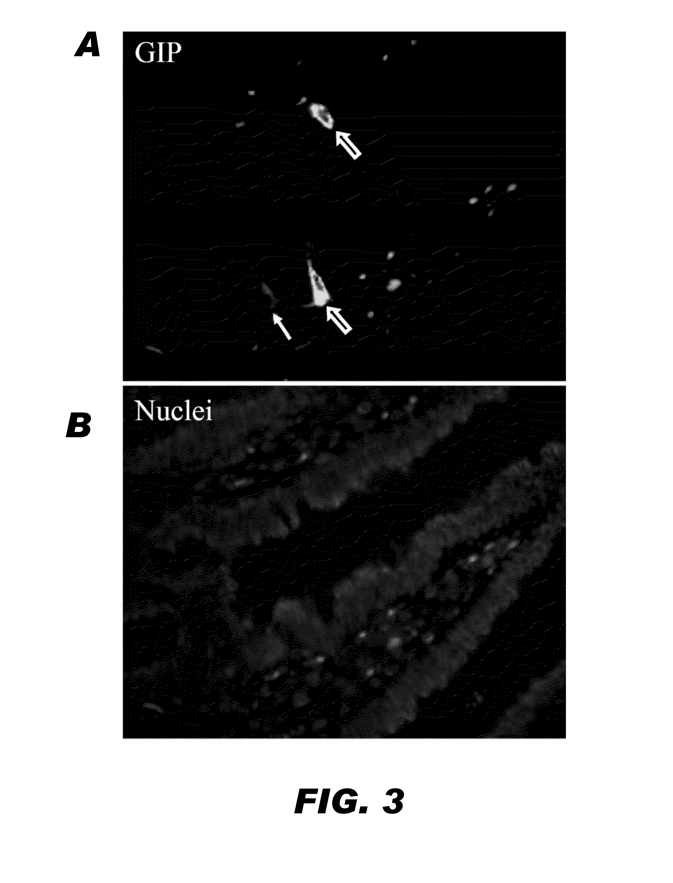 Methods and compositions for modulating insulin regulation