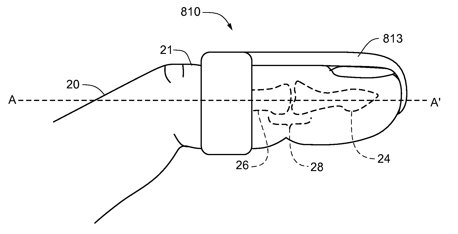 Dip joint extension splint and methods of using same