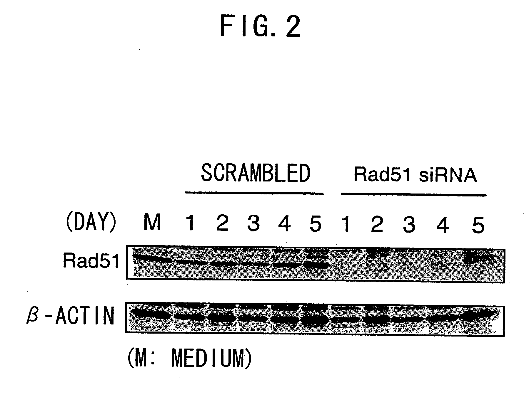 Rad51 Expression Inhibitors, Pharmaceutical Agents Containing The Inhibitors As Active Ingredients, And Uses Thereof