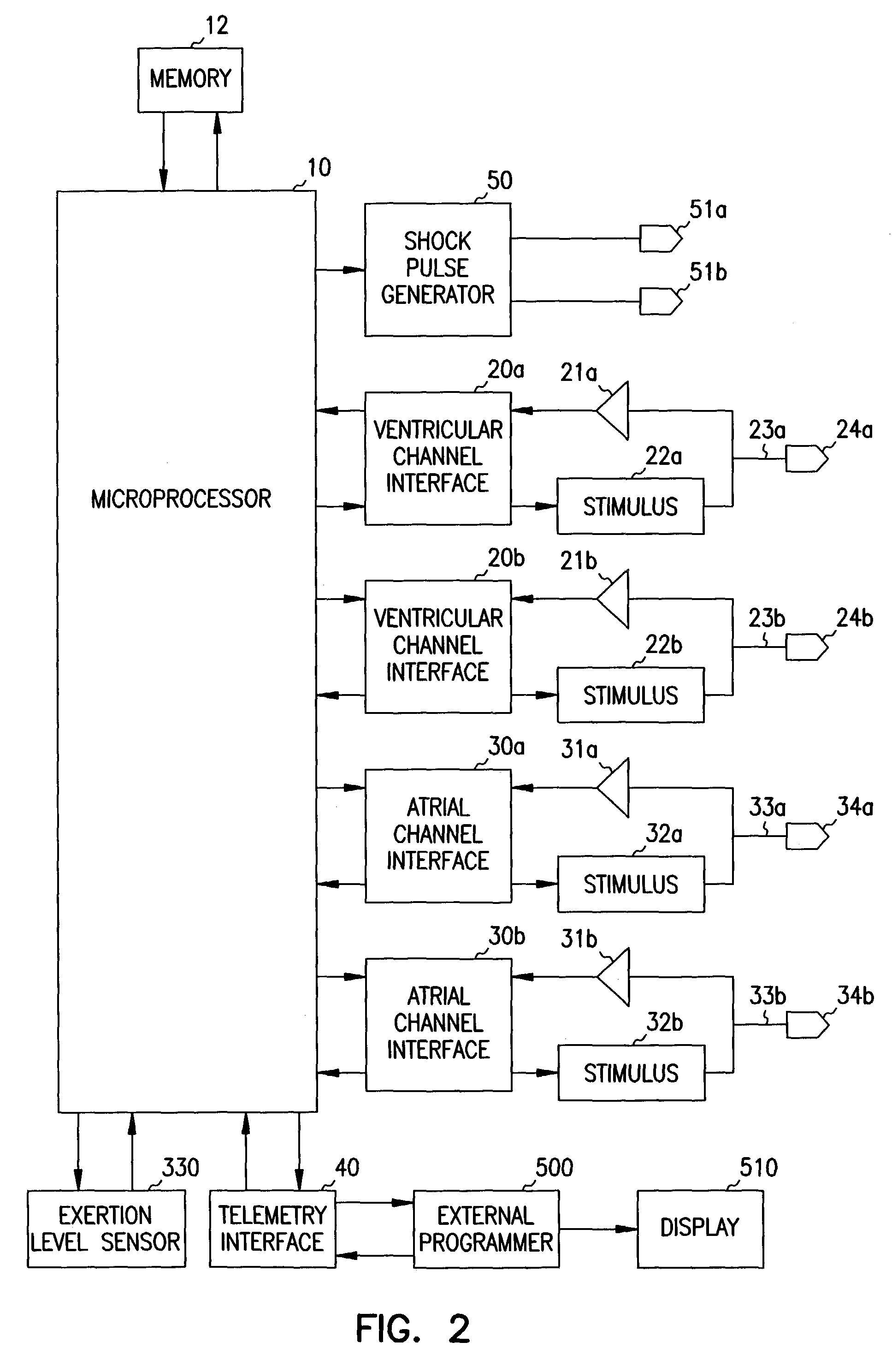 Apparatus and method for ventricular rate regularization