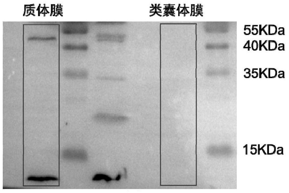 A kind of recombinant cyanobacteria expressing fatty acid with high efficiency and preparation method thereof