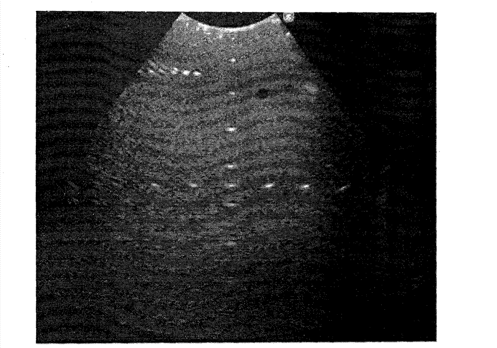 Method for optimizing acoustic parameters in imaging of self-adaptive medical ultrasonic system