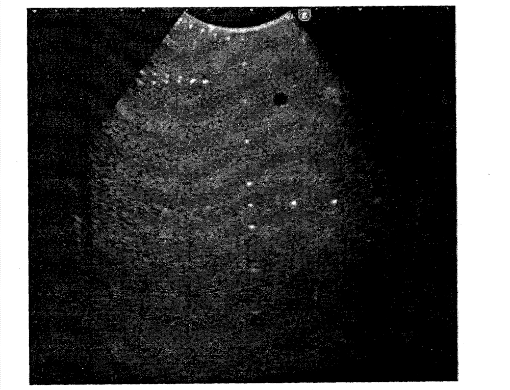 Method for optimizing acoustic parameters in imaging of self-adaptive medical ultrasonic system