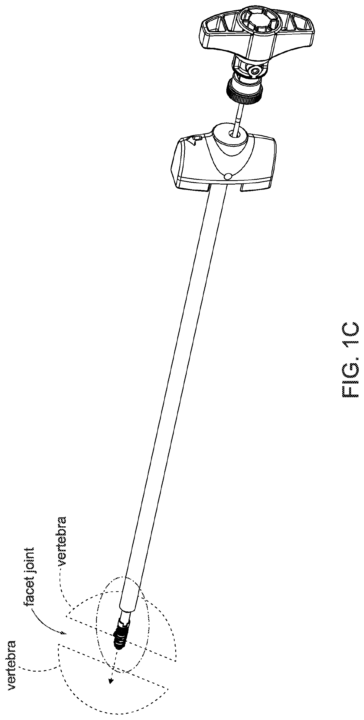 Facet screw and delivery device