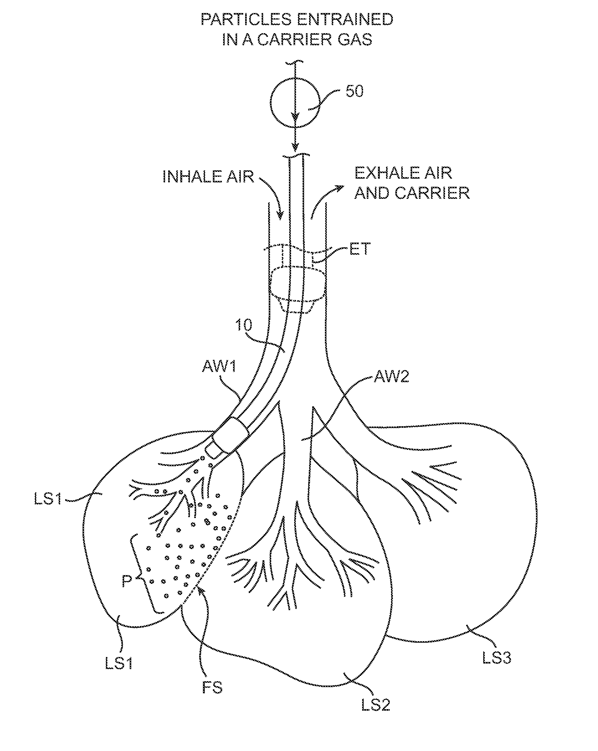 Methods and systems for occluding collateral flow channels in the lung