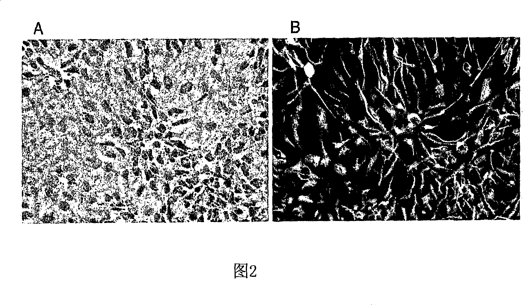 Transplantation of human neural cells for treatment of neurodegenerative conditions