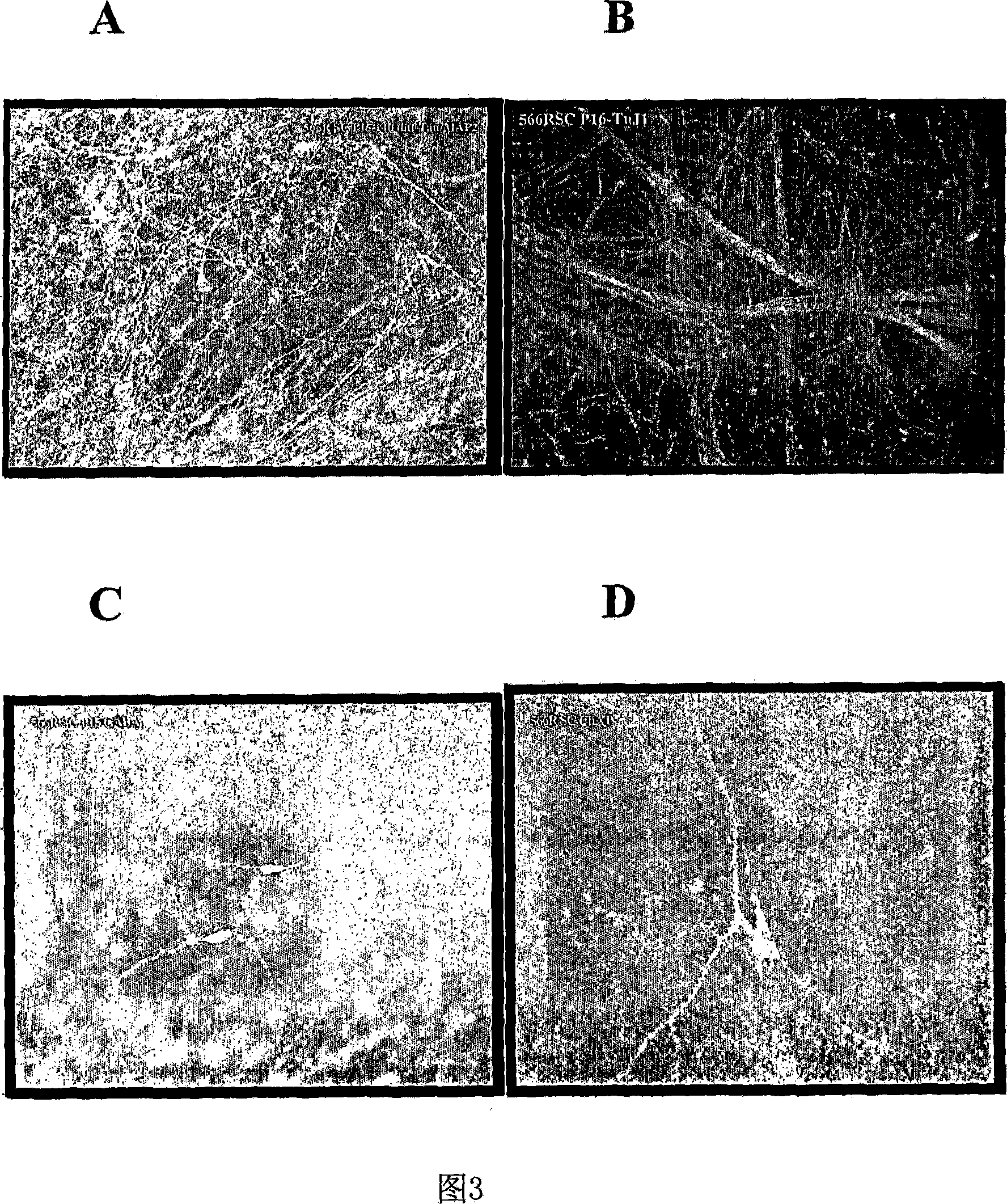 Transplantation of human neural cells for treatment of neurodegenerative conditions