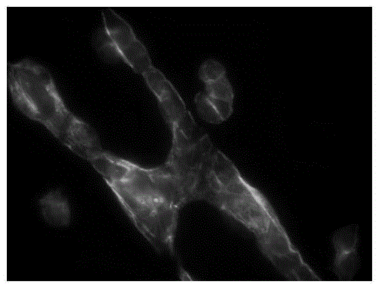 Application of diclofenac sodium to preparation of medicine for inhibiting tumor cell metastasis and spreading