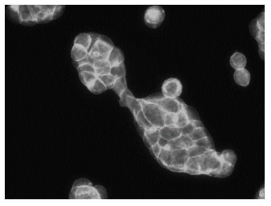 Application of diclofenac sodium to preparation of medicine for inhibiting tumor cell metastasis and spreading