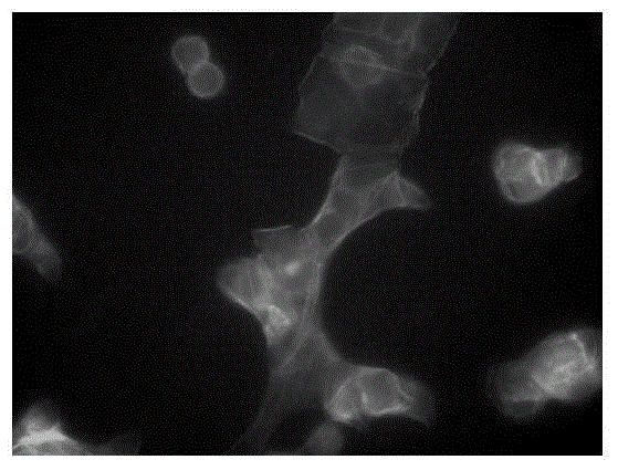 Application of diclofenac sodium to preparation of medicine for inhibiting tumor cell metastasis and spreading