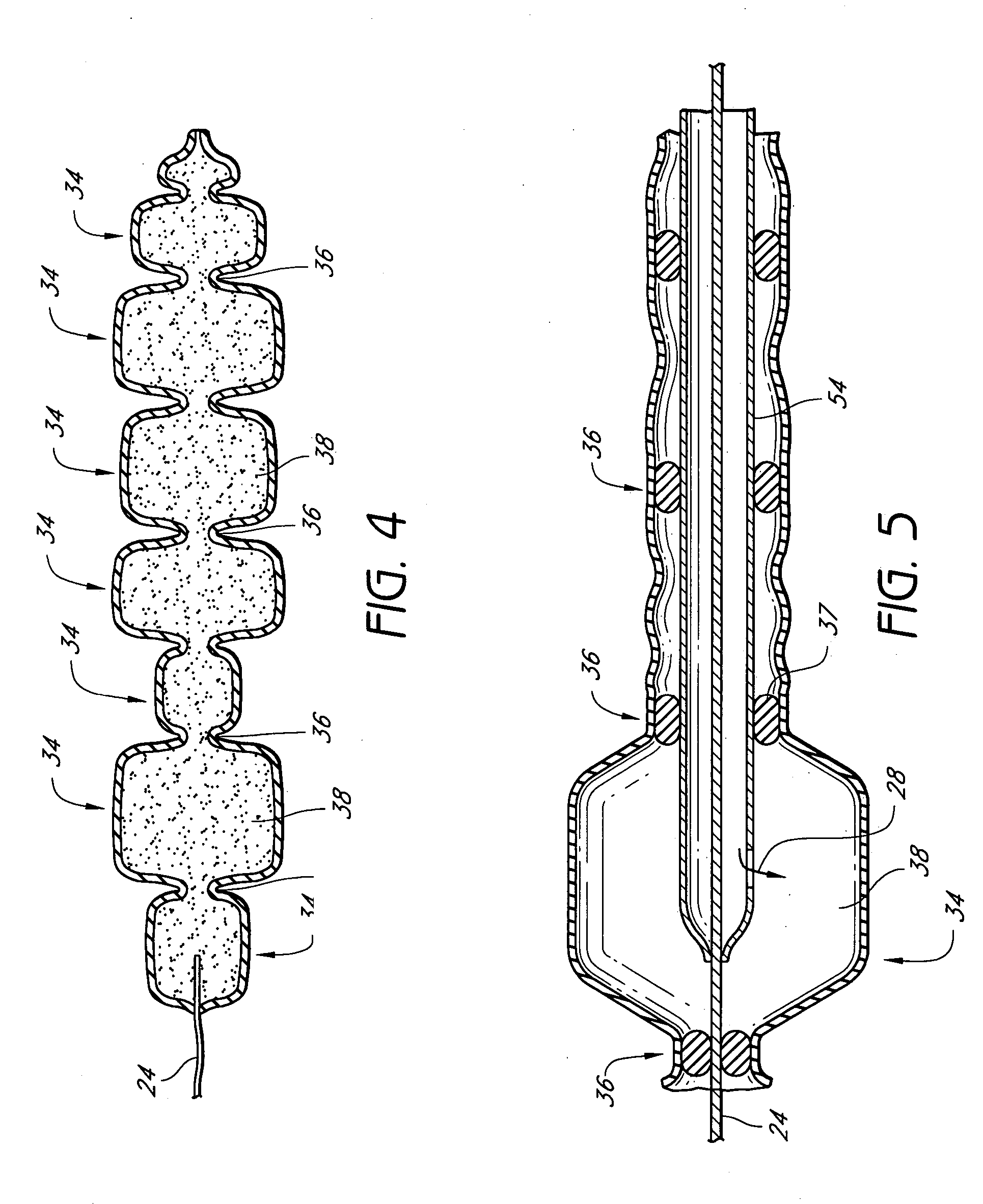 Valved tissue augmentation implant