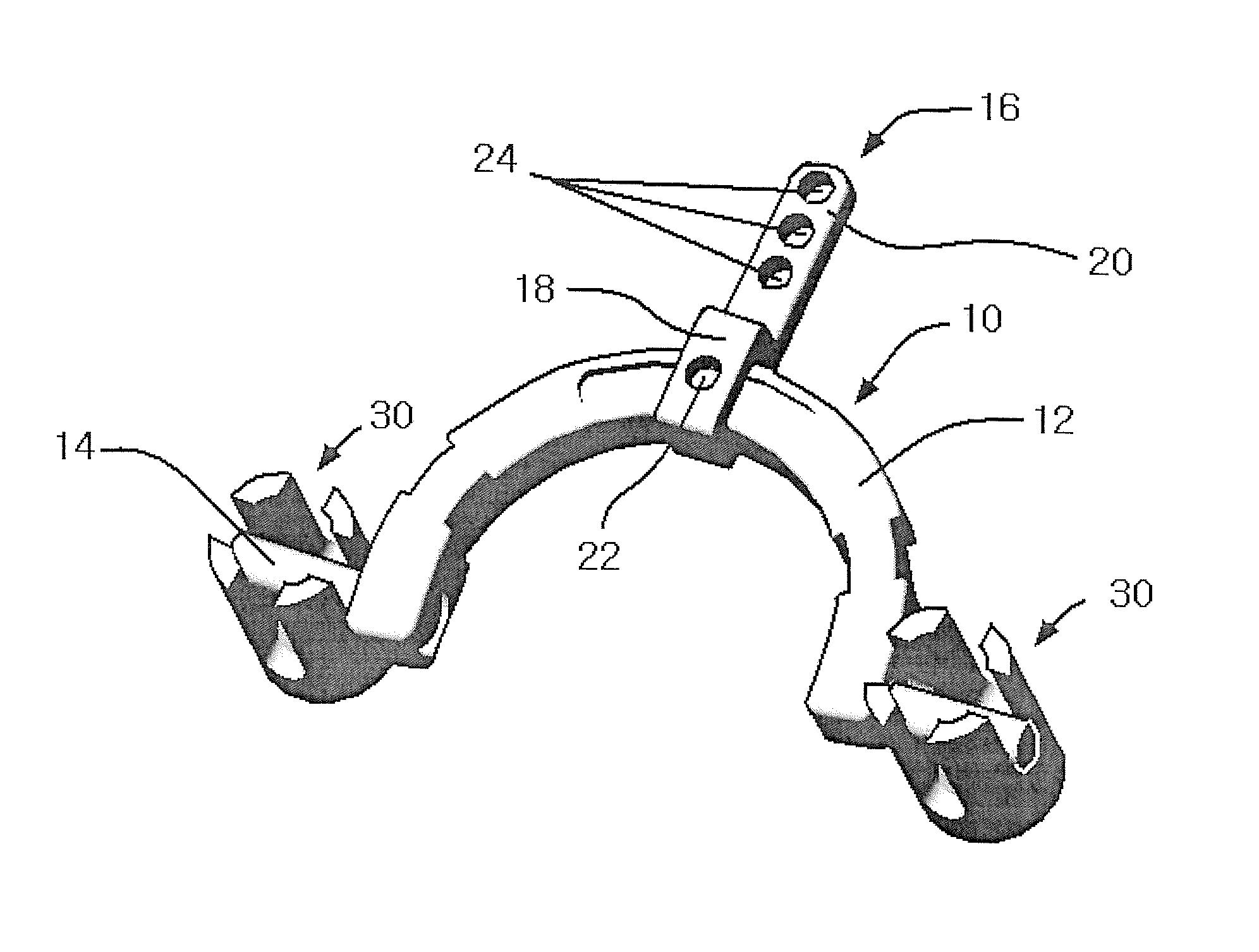 Apparatus for occipital-cervical fixation enabling supplemental occipital bone fixation