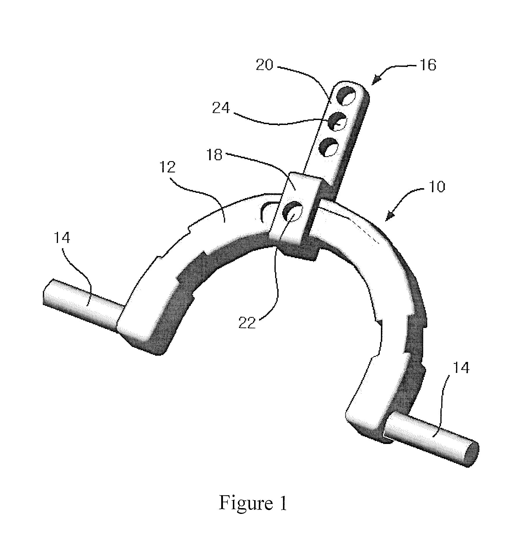 Apparatus for occipital-cervical fixation enabling supplemental occipital bone fixation