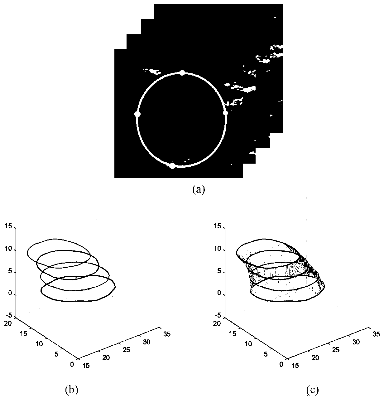 Three-dimensional carotid artery ultrasonic image blood vessel wall segmentation method based on deep learning