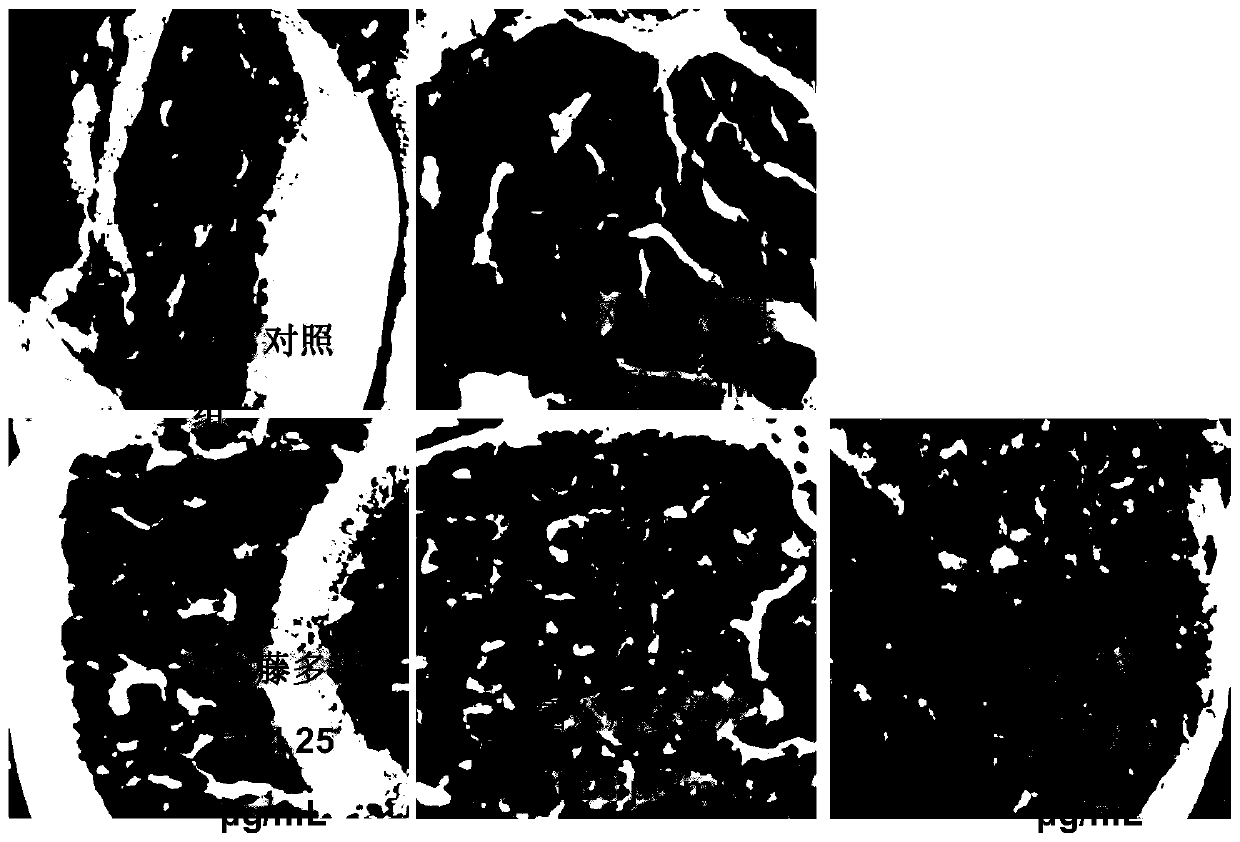 Construction method and application of animal model of liver injury induced by tripterygium glycosides