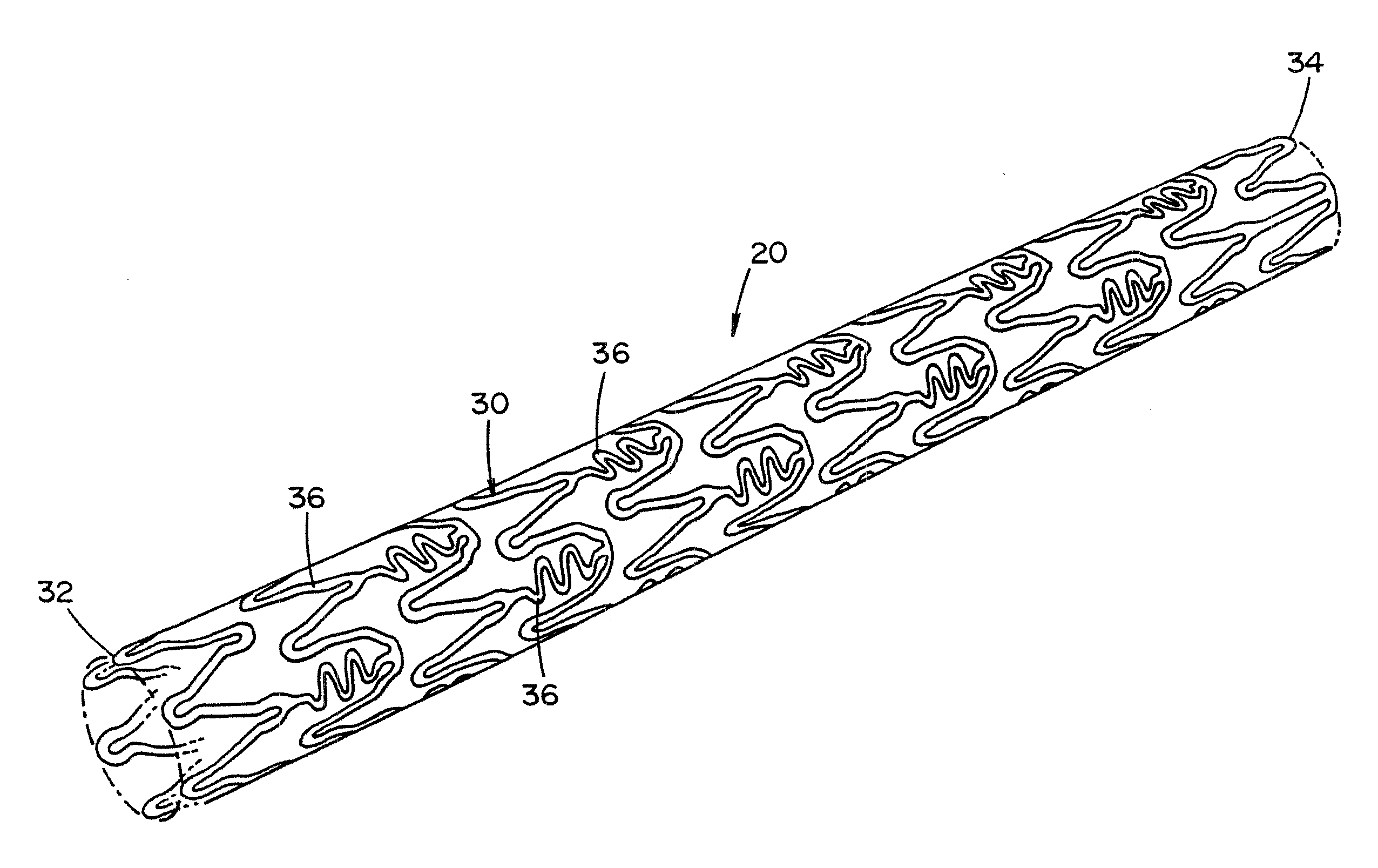 Method for forming a tubular medical device