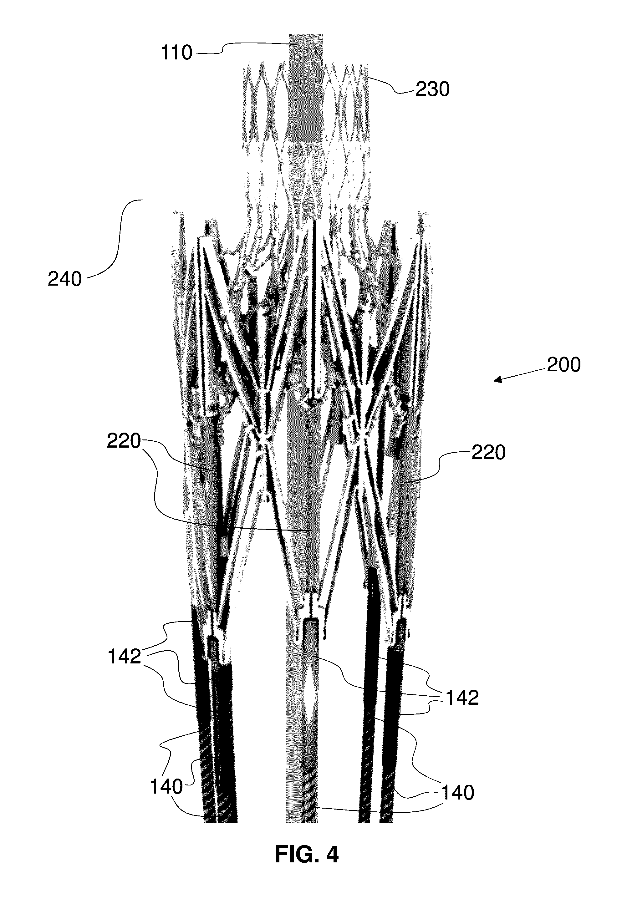 Actively Controllable Heart Valve Implant and Method of Controlling Same