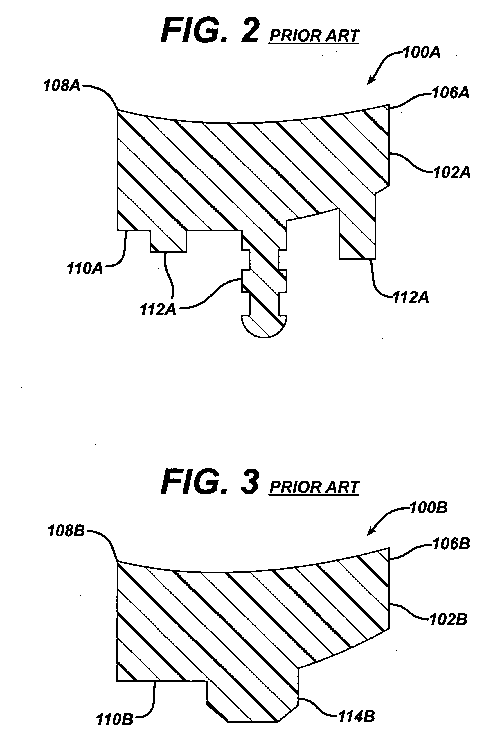 Glenoid augment and associated method