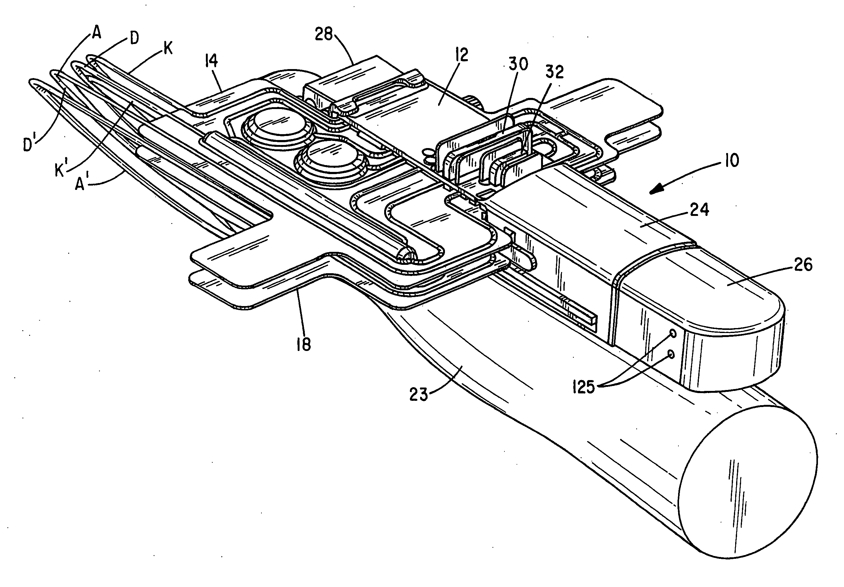 Chronic access system for extracorporeal treatment of blood including a continously wearable hemodialyzer