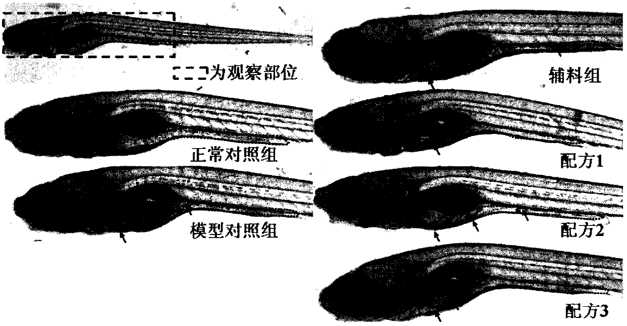 A kind of anti-pm2.5 chewable tablet and preparation method thereof