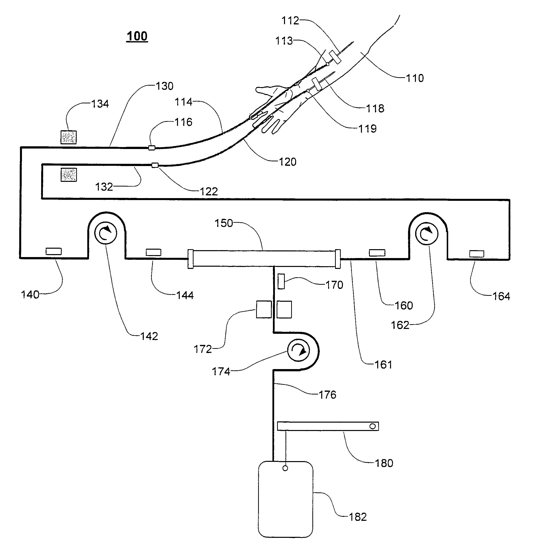 Extracorporeal blood treatment and system having reversible blood pumps