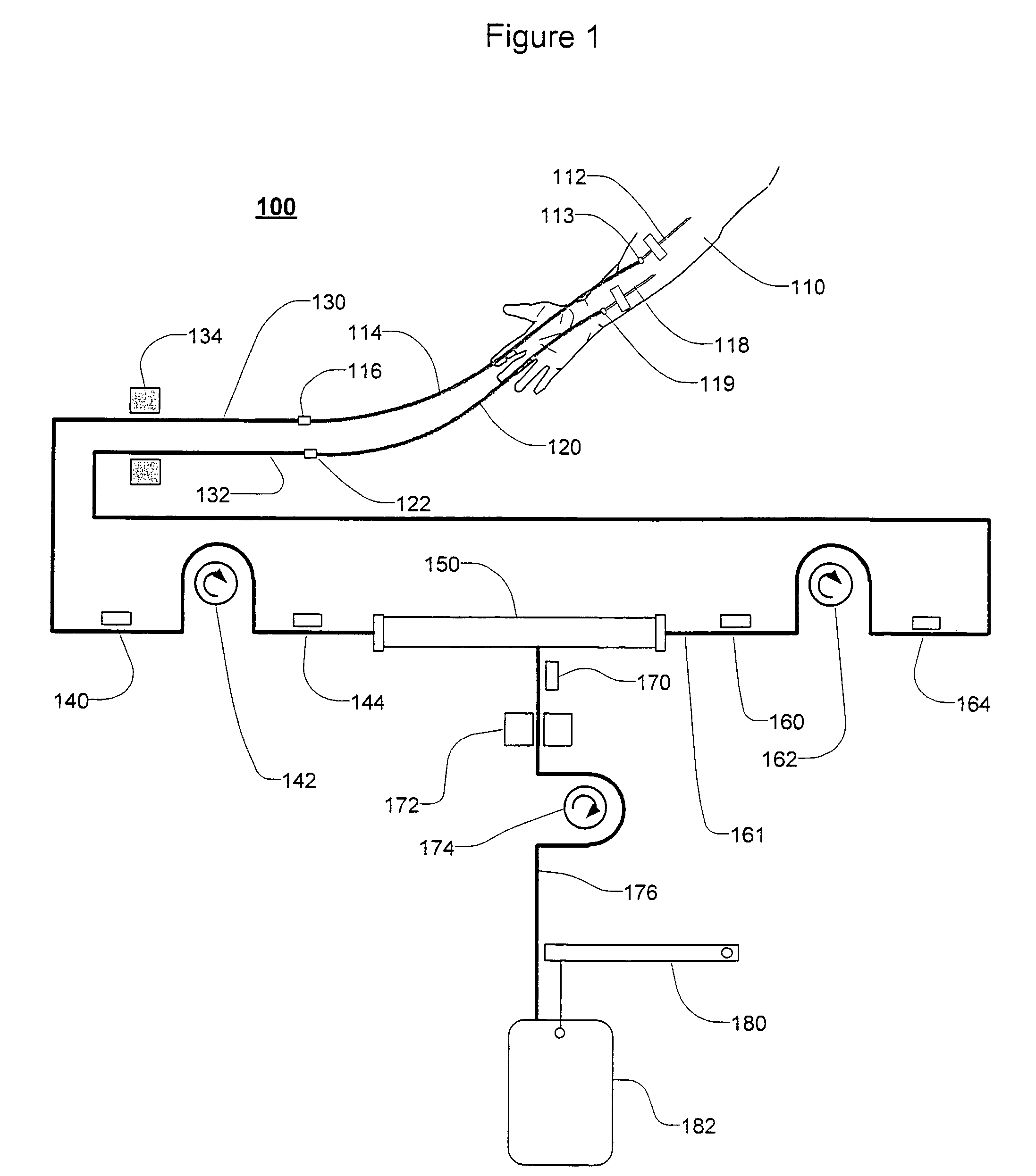 Extracorporeal blood treatment and system having reversible blood pumps