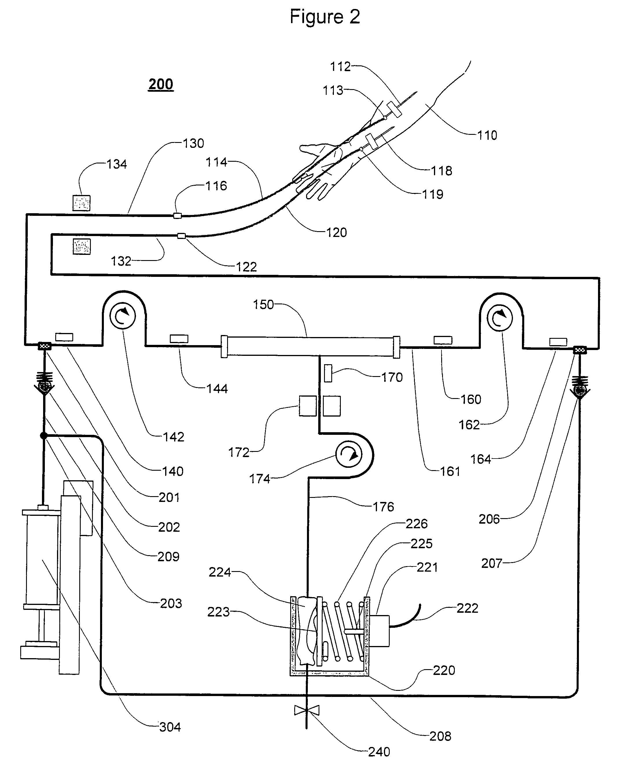 Extracorporeal blood treatment and system having reversible blood pumps