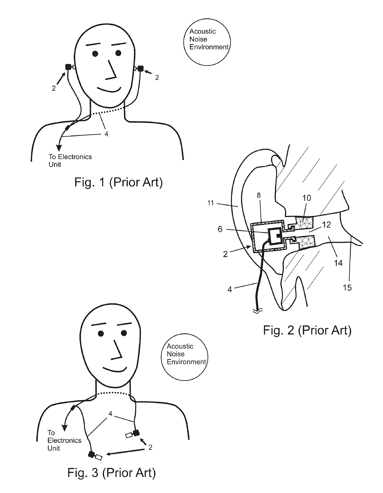 In-ear noise dosimetry system