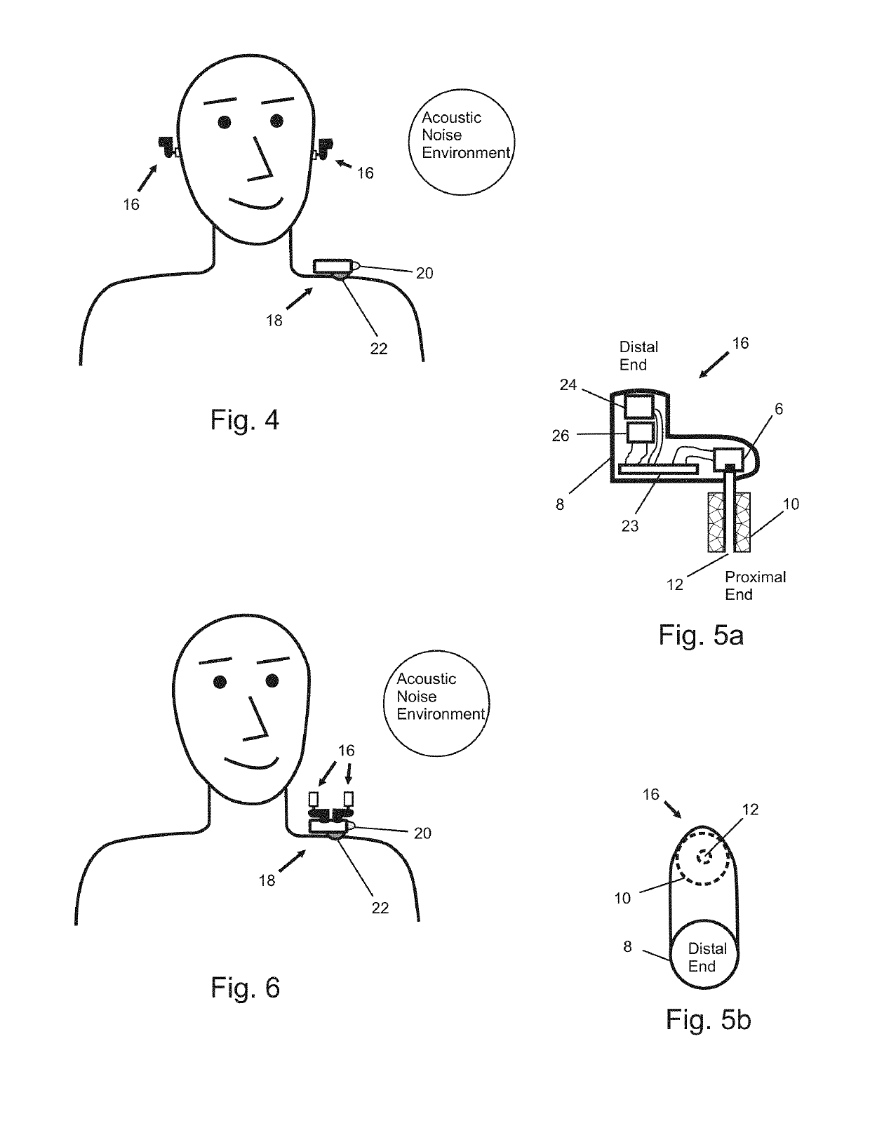 In-ear noise dosimetry system