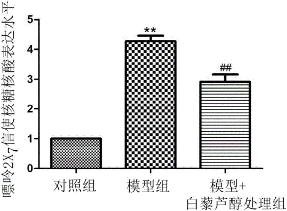 Application of resveratrol in preparing medicines for treating human immunodeficiency virus glycoprotein 120 induced neuropathic pains