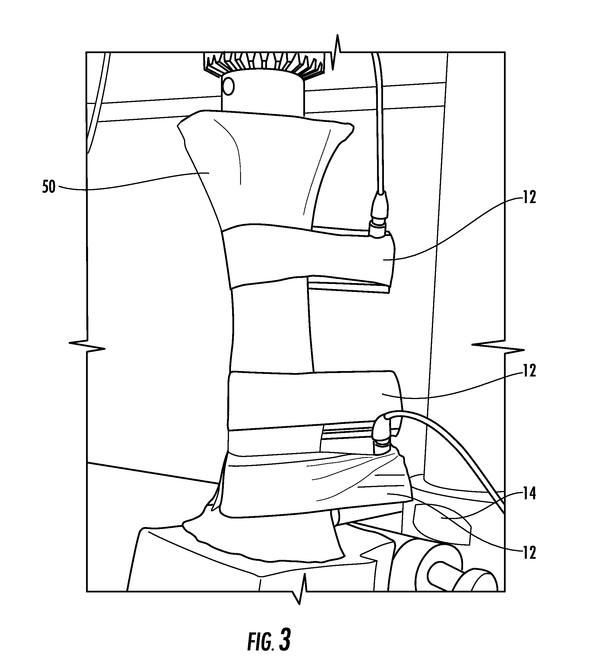 Method and system for monitoring skeletal defects