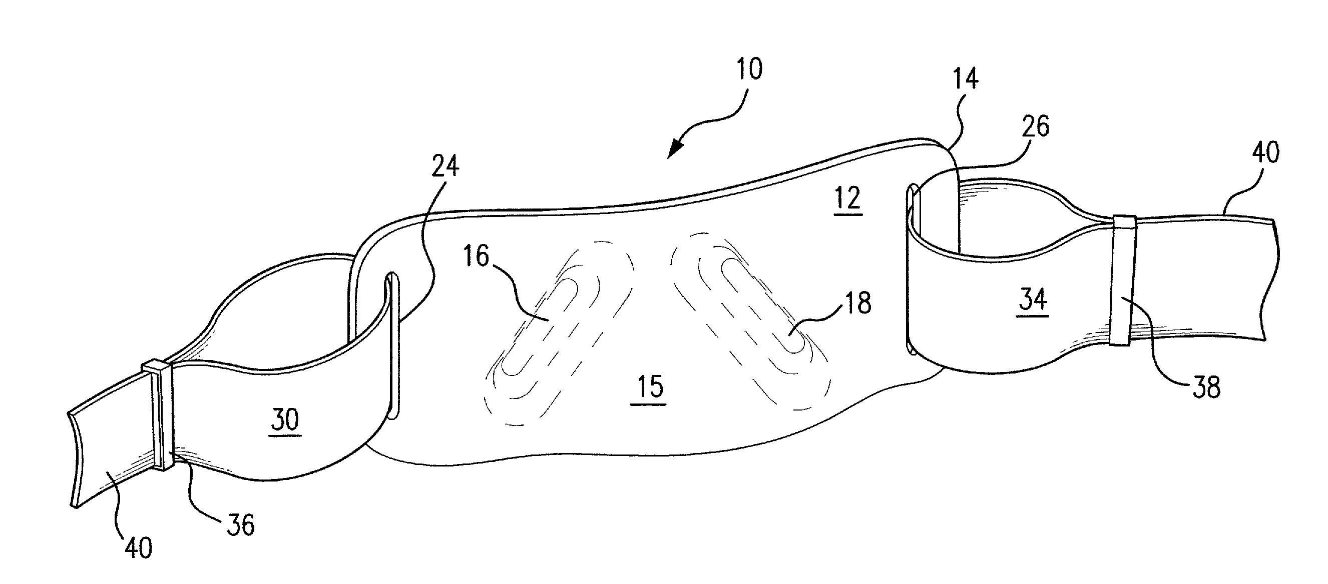 Anti-reflux/heartburn treatment device