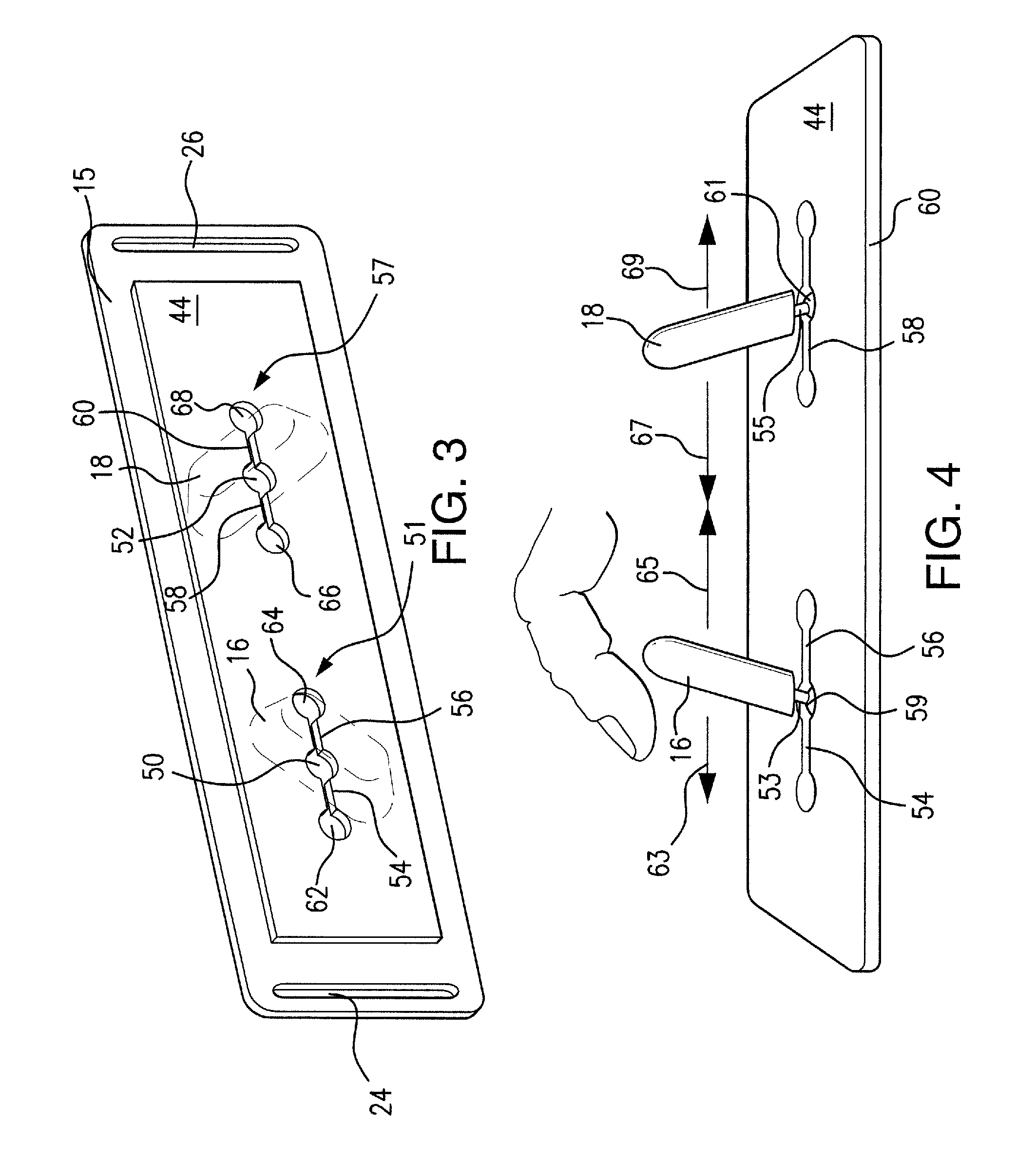 Anti-reflux/heartburn treatment device