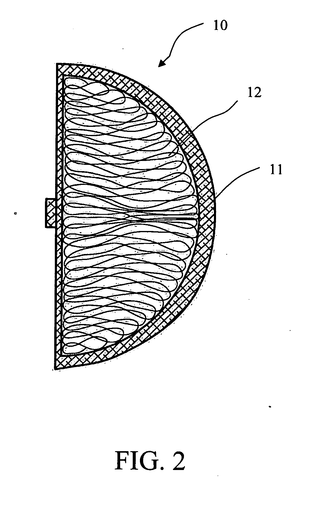 Breast implant and method of manufacture