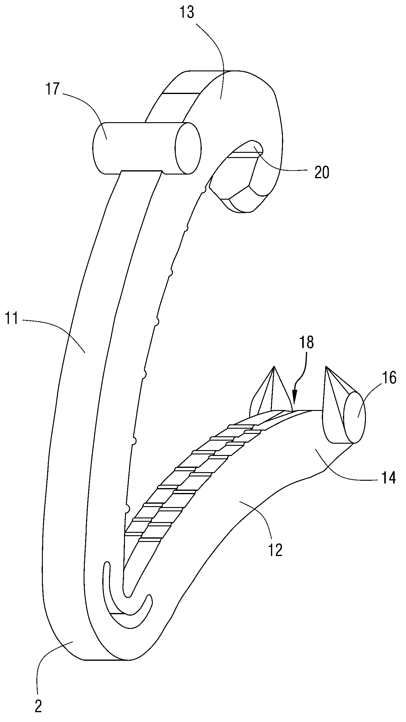 Ligation clip