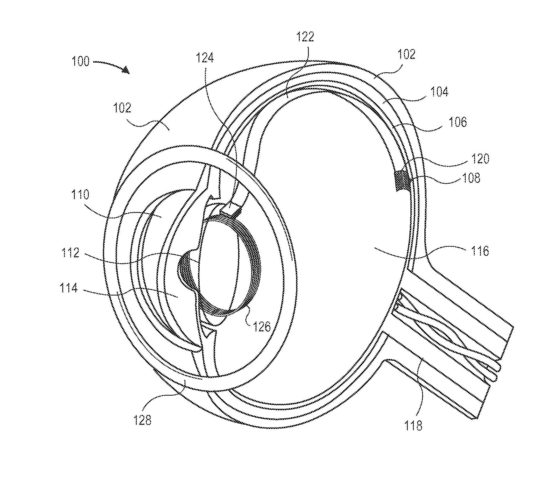 3-coil wireless power transfer system for eye implants