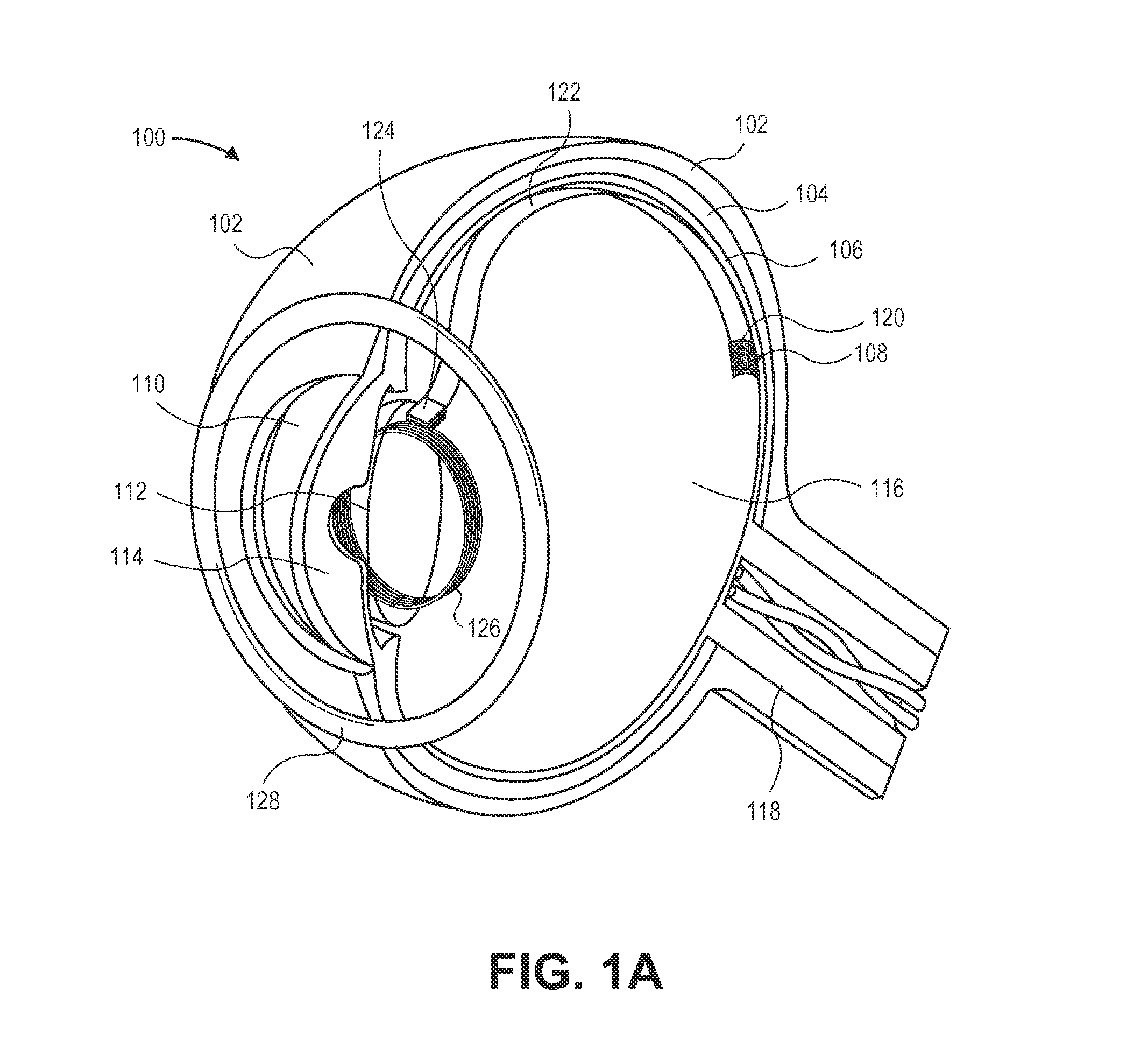 3-coil wireless power transfer system for eye implants