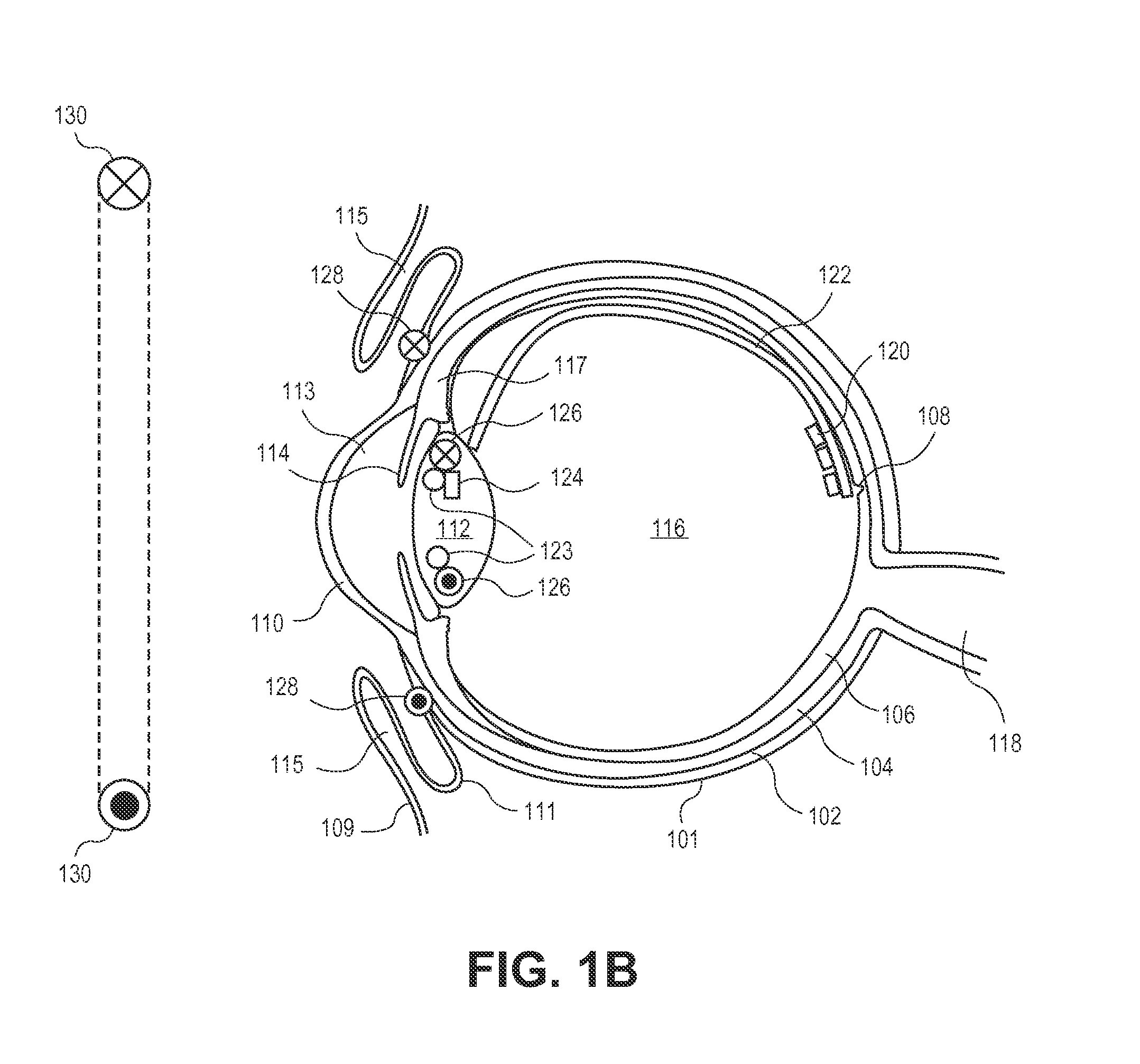 3-coil wireless power transfer system for eye implants