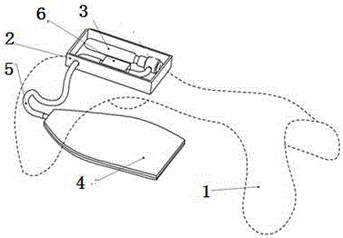 Limiting system capable of limiting animal action